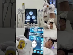 12d hifu + vmax + M8 + HAMMER 4 W 1